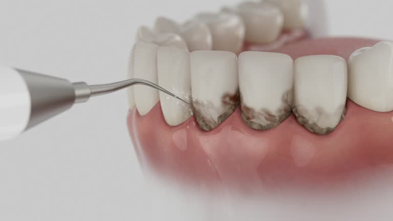 Trusted Tooth Extraction service in Portage, IN - Dentist Open Now